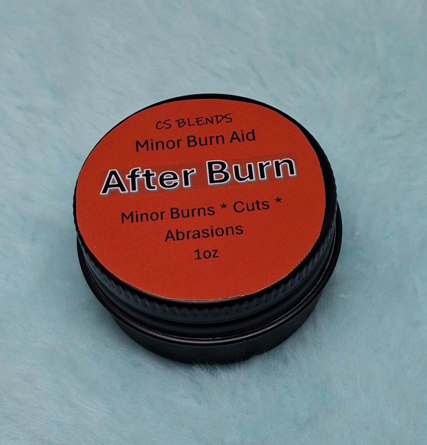 "After Burn" Burn Care Balm - Comfrey & Plantain Skin Support